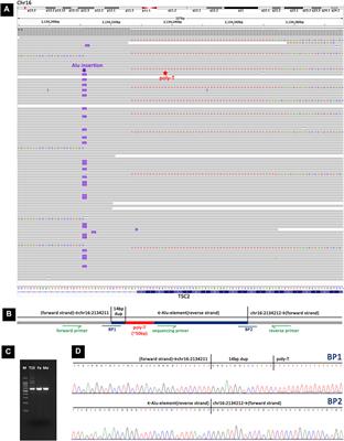 Uncovering hidden genetic variations: long-read sequencing reveals new insights into tuberous sclerosis complex
